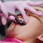 Betäubung vom Zahnarzt - Die Dauer